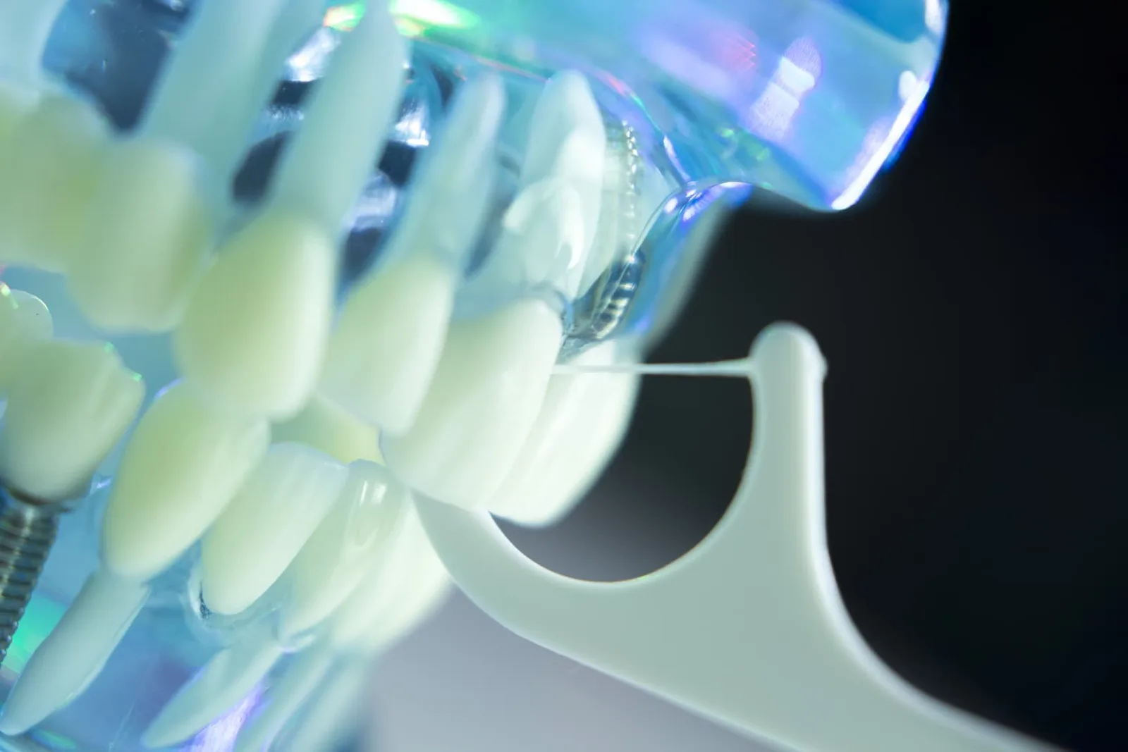 What Is the Success Rate of Dental Implants? — Samuel F. Jirik DDS, Cabot, Arkansas